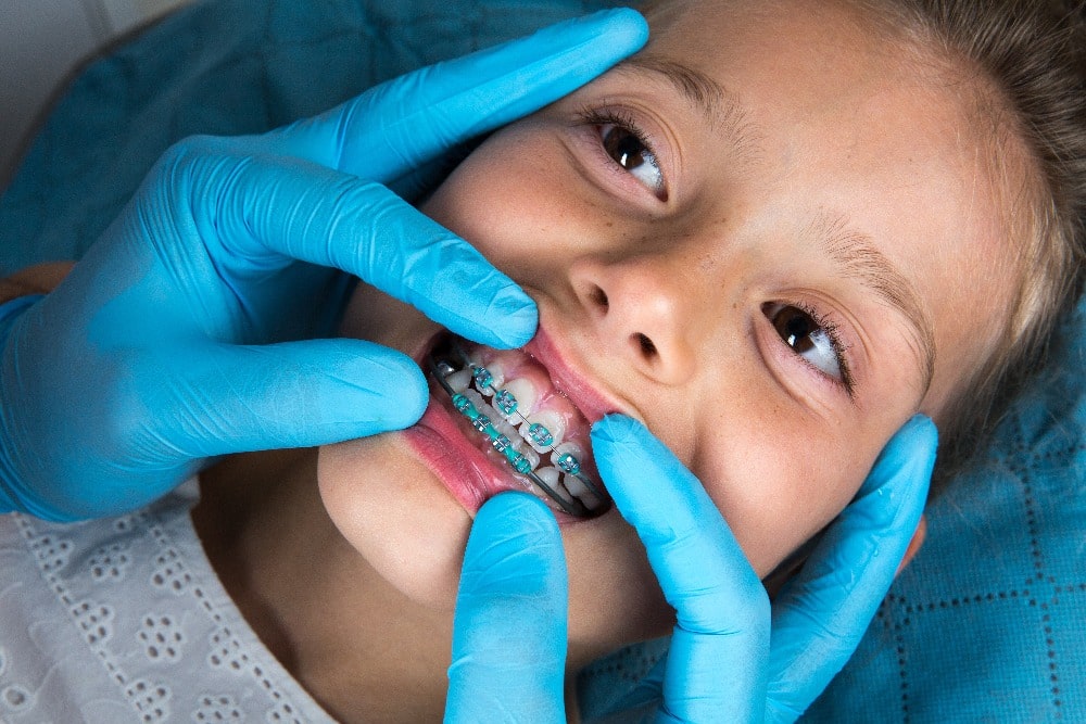 best-orthodontist-for-children